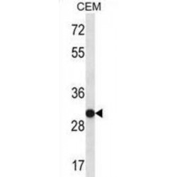 U1 Small Nuclear Ribonucleoprotein A (SNRPA) Antibody