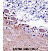 Septin 5 (SEPTIN5) Antibody