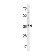 Microtubule Associated Protein RP/EB Family Member 2 (MAPRE2) Antibody