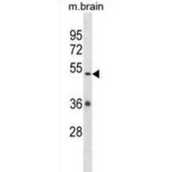 CaM Kinase-Like Vesicle-Associated Protein (Camkv) Antibody