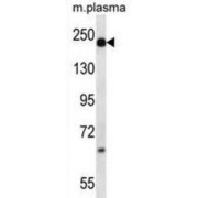 Alpha-2-Macroglobulin (A2M) Antibody