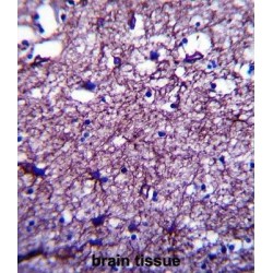 Disrupted In Schizophrenia 1 Protein (DISC1) Antibody