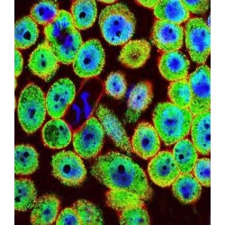 Jupiter Microtubule Associated Homolog 1 (JPT1) Antibody