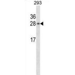 Jupiter Microtubule Associated Homolog 1 (JPT1) Antibody