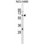 Wolf-Hirschhorn Syndrome Candidate 2 Protein (WHSC2) Antibody