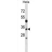 Linker For Activation of T-Cells Family, Member 2 (LAT2) Antibody