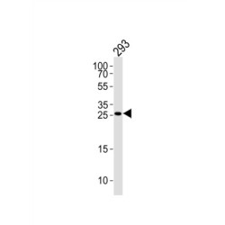 TGFB Induced Factor Homeobox 2 (TGIF2) Antibody