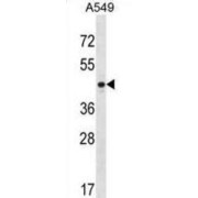 Pentraxin 3 (PTX3) Antibody