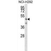 Transmembrane Protease, Serine 5 (TMPRSS5) Antibody