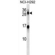 Kallikrein 14 (KLK14) Antibody