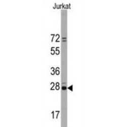 CD9 Antigen (CD9) Antibody