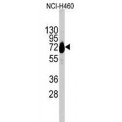 Cadherin 10 (CDH10) Antibody