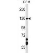 Structural Maintenance of Chromosomes Protein 3 (SMC3) Antibody