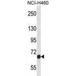Fibroblast Growth Factor Receptor 1 (Fgfr1) Antibody