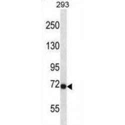 Fibroblast Growth Factor Receptor 3 (Fgfr3) Antibody