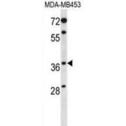 Membrane Progestin Receptor Beta (PAQR8) Antibody