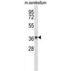 Membrane Progestin Receptor Beta (PAQR8) Antibody