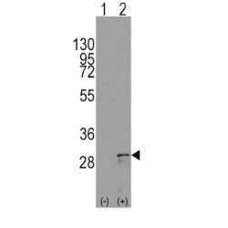 Kit Ligand (KITLG) Antibody