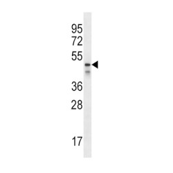 Na(+)/H(+) Exchange Regulatory Cofactor NHE-RF3 (PDZK1) Antibody