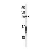 RAS-Related Protein RAP1B (RAP1B) Antibody