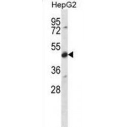 Cerebellar Degeneration-Related Protein 2 (CDR2) Antibody