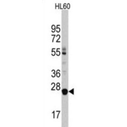 Lin-28 Homolog B (LIN28B) Antibody