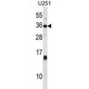 Stanniocalcin 1 (STC1) Antibody