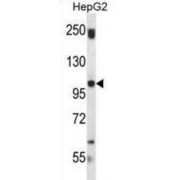 Staphylococcal Nuclease Domain-Containing Protein 1 (SND1) Antibody