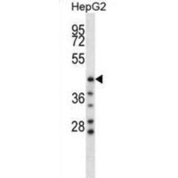 Hyaluronidase-1 (HYAL1) Antibody