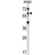 Zinc Finger Protein RFP (TRIM27) Antibody