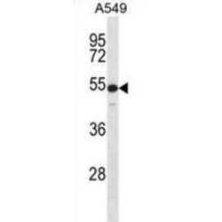 Keratin, Type II Cytoskeletal 7 (KRT7) Antibody