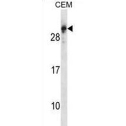 Regulator Of G Protein Signaling 5 (RGS5) Antibody