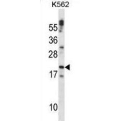 Cardiotrophin 1 (CTF1) Antibody