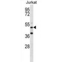RNA Binding Motif Protein 22 (RBM22) Antibody