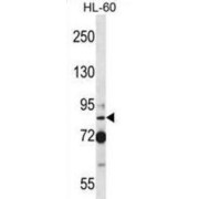 Selenocysteine Insertion Sequence-Binding Protein 2 (SECISBP2) Antibody