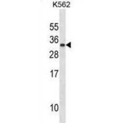 Prolactin (PRL) Antibody