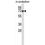 Glycine Receptor Beta (GLRB) Antibody