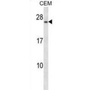 B-Cell Antigen Receptor Complex-Associated Protein Alpha Chain (CD79A) Antibody