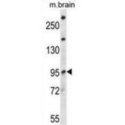 E3 Ubiquitin-Protein Ligase NEDD4-Like (NEDD4L) Antibody