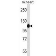 Actinin Alpha 2 (ACTN2) Antibody