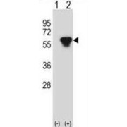 Protein Kinase cAMP-Dependent Type II Regulatory Subunit Beta (PRKAR2B) Antibody