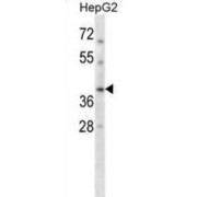 RAD51 Paralog C (RAD51C) Antibody