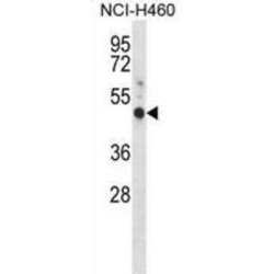 G Protein Coupled Estrogen Receptor 1 (GPER1) Antibody