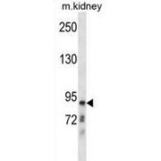 Chloride Voltage-Gated Channel Kb (CLCNKB) Antibody