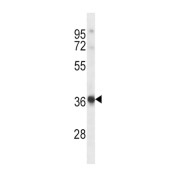 Histamine H2 Receptor (HRH2) Antibody