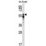 Protein Phosphatase 2 Regulatory Subunit B'Alpha (PPP2R5A) Antibody