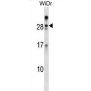 Azurocidin 1 (AZU1) Antibody