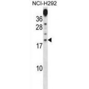 Proline-Rich Protein 15 (PRR15) Antibody