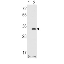 Cyclin-Dependent Kinase 1 (CDK1) Antibody