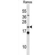 COP9 Signalosome Subunit 8 (COPS8) Antibody